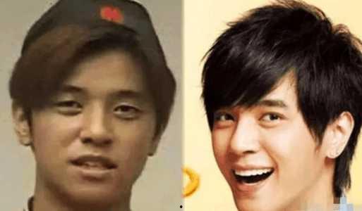 越整越丑的明星